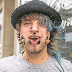 Тоннели в щеках