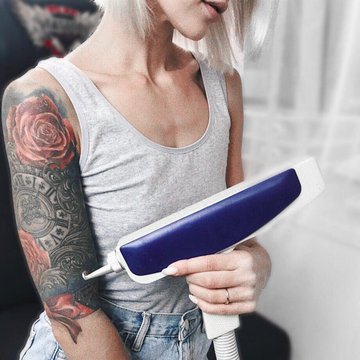 Видалення татуажу в Івано-Франківську