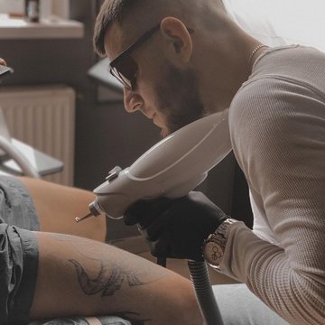 Лазерне видалення тату в Києві