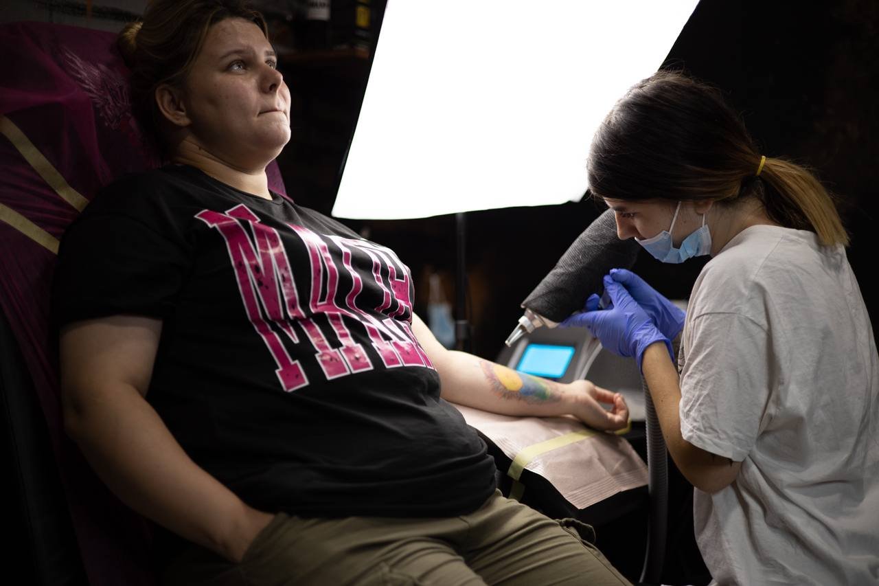 Laser tattoo removal in Kolomyia