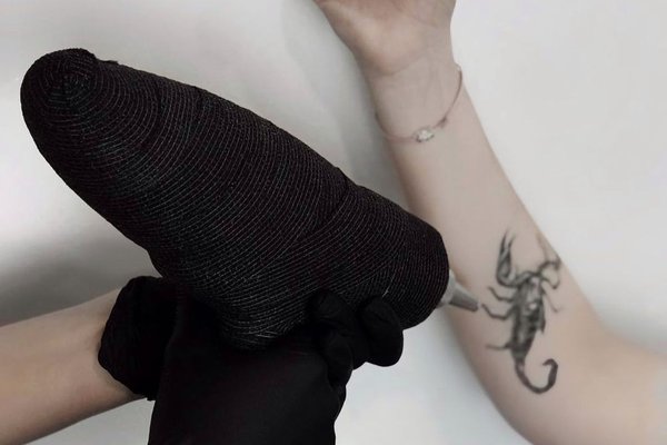 Laser tattoo removal in Kiev